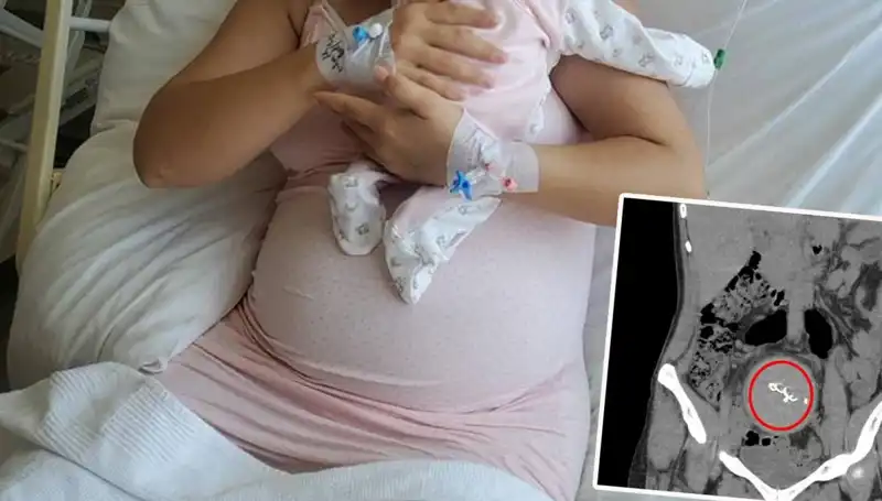 Doğumda Unutulan Bebek İki Yıl Sonra Ortaya Çıktı: Gazlı Bez İhmaline Soruşturma